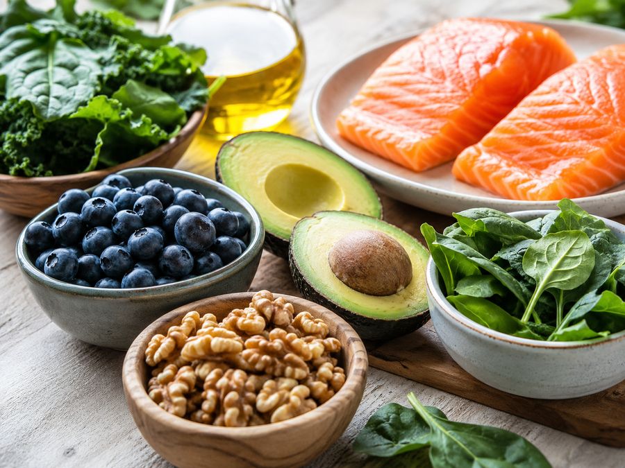 Healthy foods that support brain health including salmon, blueberries, walnuts, and leafy greens